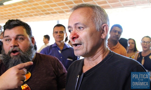 Professor disse que levou soco no rosto (Foto: Jailson Soares/PoliticaDinamcia.com)